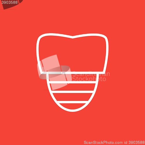 Image of Tooth implant line icon.