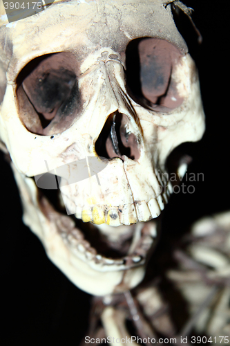 Image of human skull bone