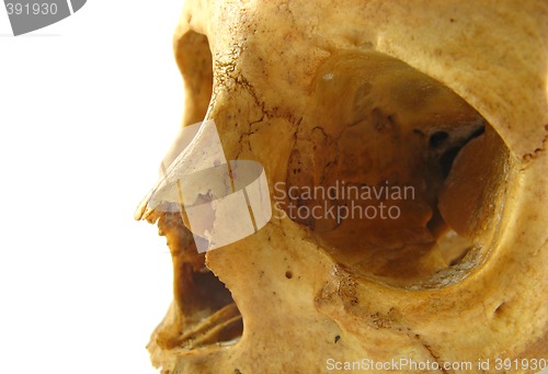 Image of skull