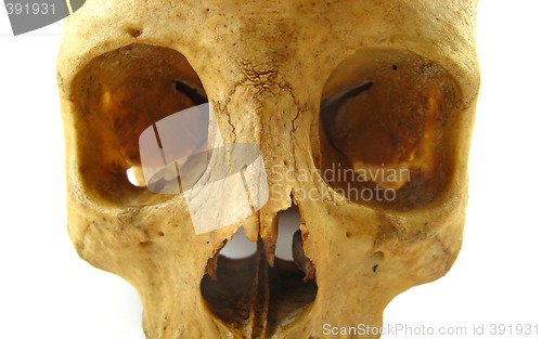 Image of skull