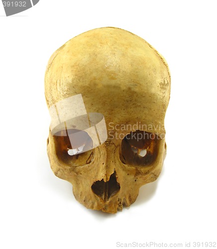 Image of skull