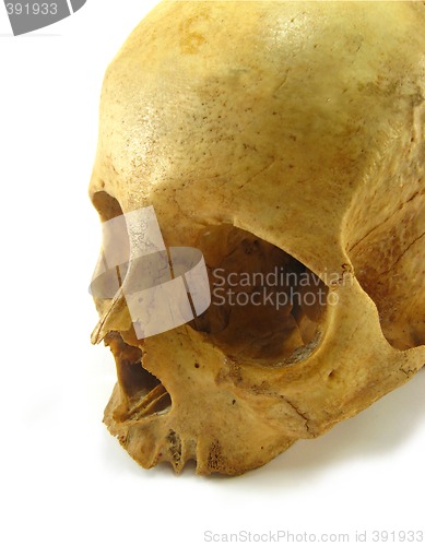 Image of skull