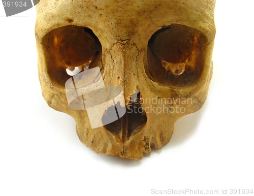 Image of skull