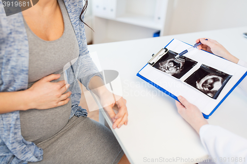 Image of close up of doctor and pregnant woman ultrasound