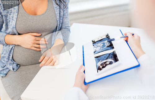 Image of close up of doctor and pregnant woman ultrasound