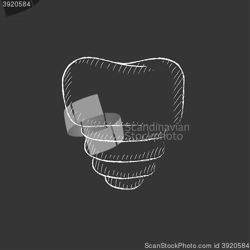 Image of Tooth implant. Drawn in chalk icon.