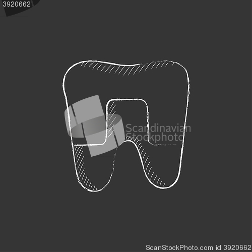 Image of Crowned tooth. Drawn in chalk icon.