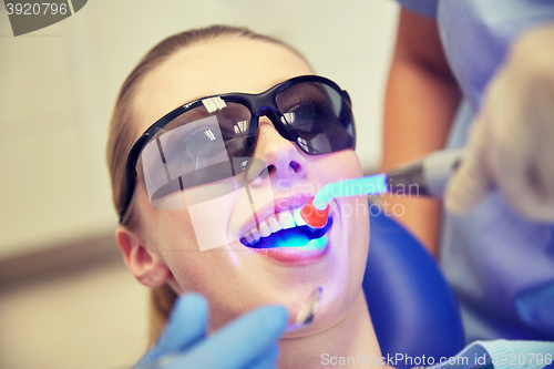 Image of close up of woman patient with dental curing light