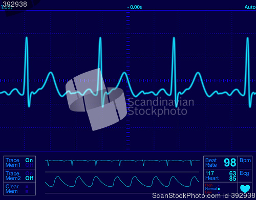 Image of heart monitor screen