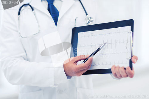 Image of male doctor hands holding cardiogram