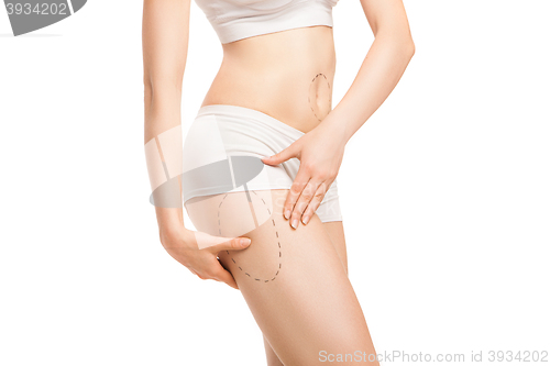 Image of Woman with outlines for plastic surgery on body