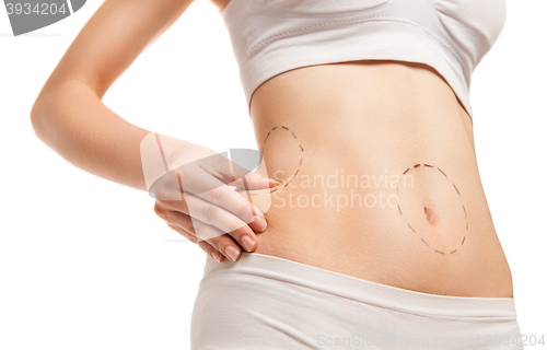 Image of Patient with outlines on body in close-up