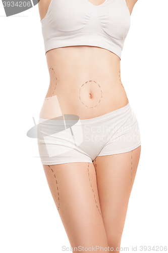 Image of Unrecognizable woman in underwear with liposuction outlines