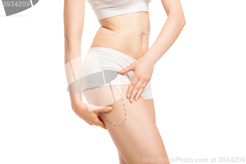 Image of Woman with outlines for plastic surgery on body