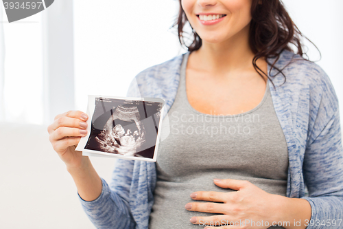 Image of close up of pregnant woman with ultrasound image