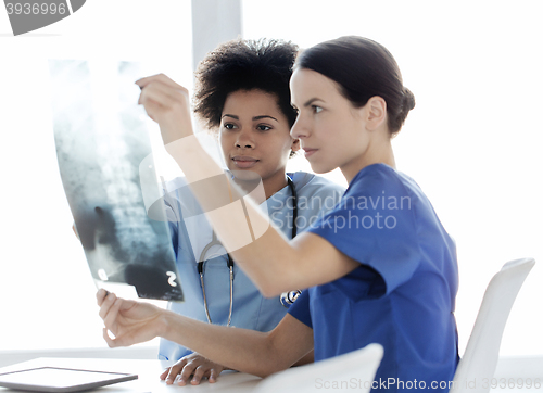 Image of doctors with x-ray image of spine at hospital