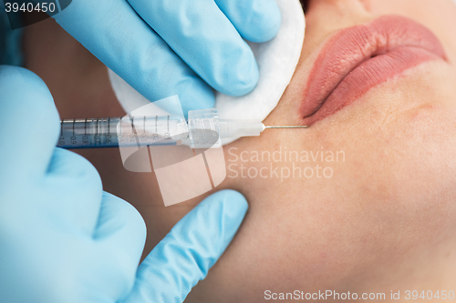 Image of woman gets injection in her lips