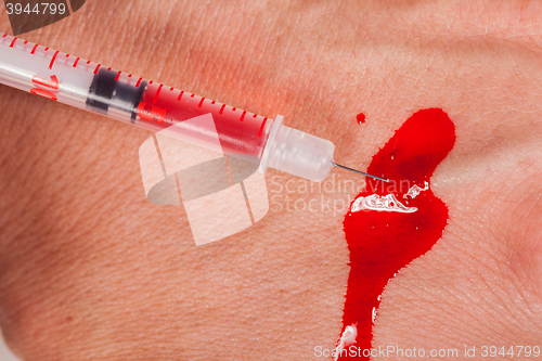 Image of Subcutaneous medical injection concept