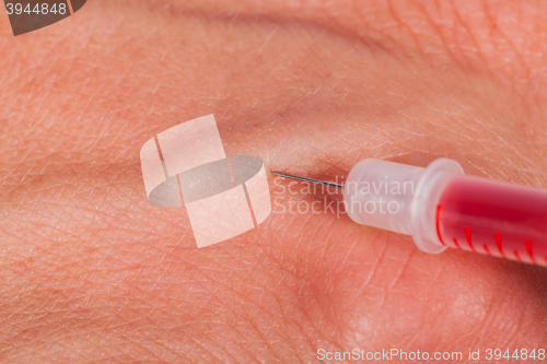 Image of Subcutaneous medical injection concept