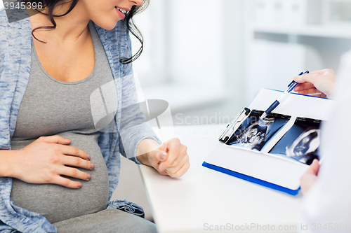 Image of close up of doctor and pregnant woman ultrasound