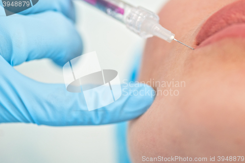 Image of woman gets injection in her lips