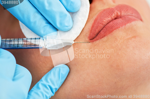 Image of woman gets injection in her lips