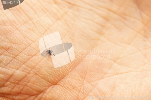 Image of Tick