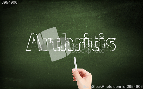 Image of  Arthritis