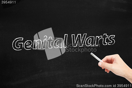 Image of Genital Warts