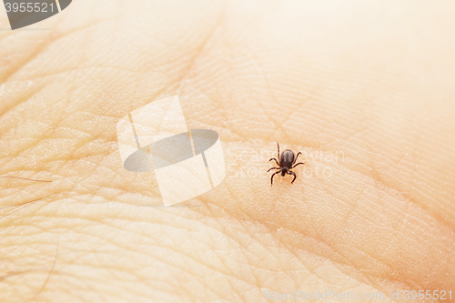 Image of Tick