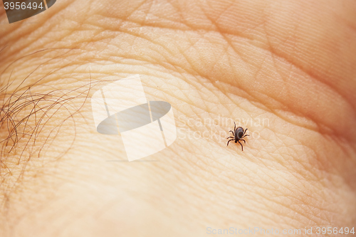 Image of Tick