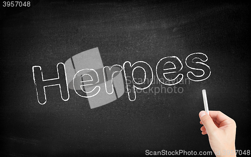 Image of Herpes