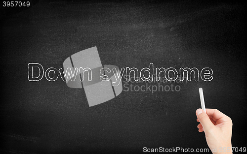 Image of Down syndrome