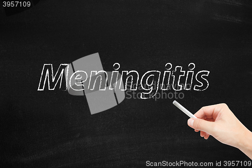 Image of Meningitis