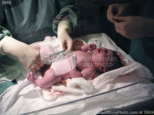 Image of Newborn - Medical examination