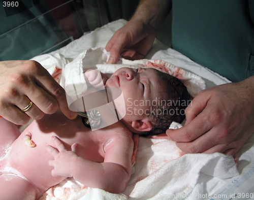 Image of Newborn - Medical examination