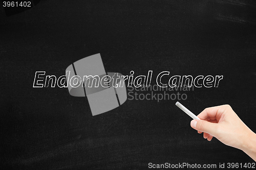 Image of Endometrial cancer