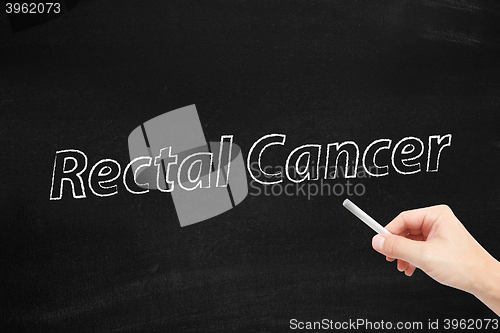 Image of Rectal cancer