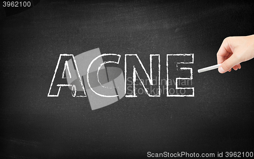 Image of Acne