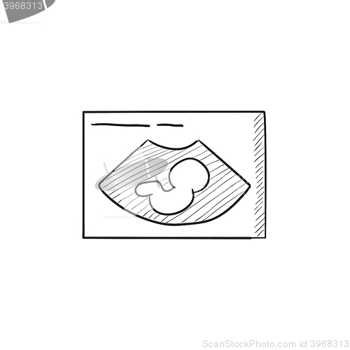 Image of Fetal ultrasound sketch icon.