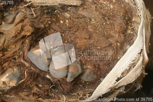 Image of mummified toe