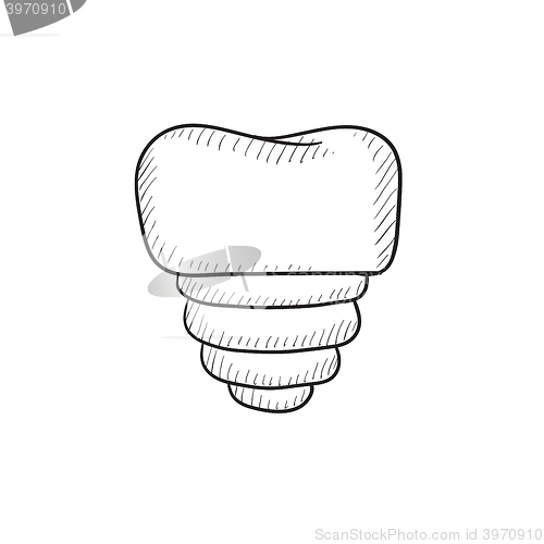 Image of Tooth implant sketch icon.