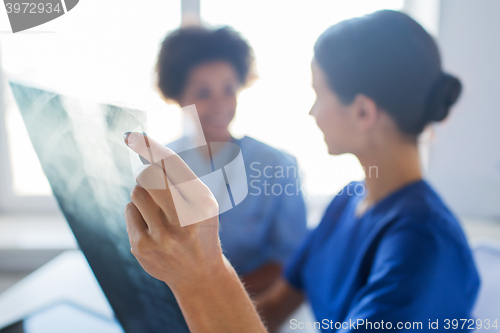 Image of close up of doctors with x-ray image at hospital