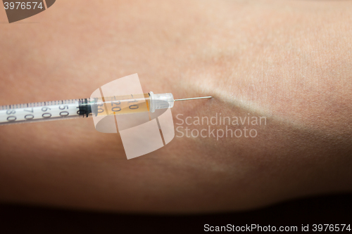 Image of close up of addict hand making drug injection