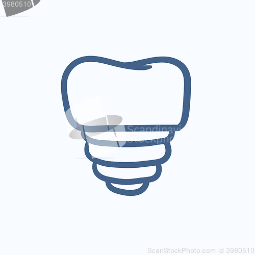 Image of Tooth implant sketch icon.