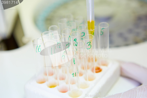 Image of pipette dropping sample into a test tube,abstract science background