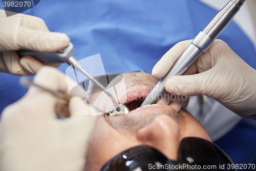 Image of dentist hands treating male patient teeth