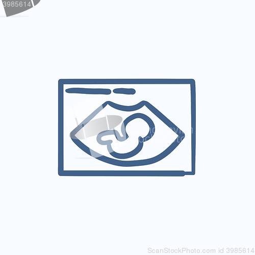 Image of Fetal ultrasound sketch icon.