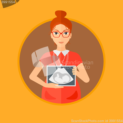 Image of Pregnant woman with ultrasound image.