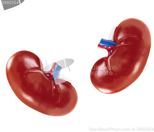 Image of artificial kidney